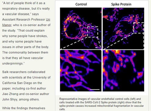 Study: Spike Protein Makes Illness Worse